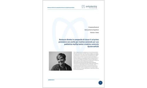 Dr. Marina Papachroni – Restauro diretto di classe II del primo premolare – QuickmatFLEX sectional matrices e myClip Junior