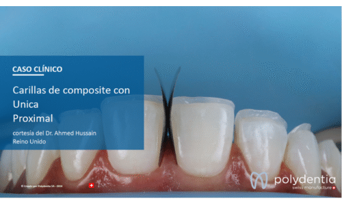 Dr Ahmed Hussain - Carillas de composite con Unica Proximal
