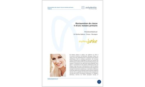 Dr. Martina Sabová - Restauration de classe II d’une molaire primaire – myRing Junior