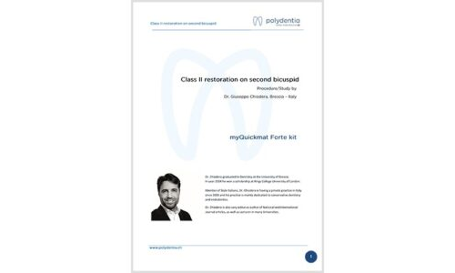 Dr. Giuseppe Chiodera – Class II restoration on second bicuspid – myQuickmat Forte kit