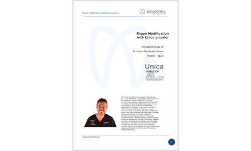 Dr. Carlos Fernández Villares – Shape Modification – Unica anterior