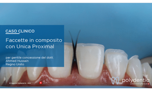 Dr Ahmed Hussain - Faccette in composito con Unica Proximal