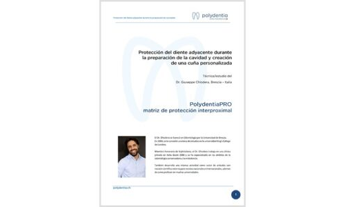 Dr. Giuseppe Chiodera –Protección del diente adyacente – Matriz de matriz de protección interproximal PolydentiaPRO