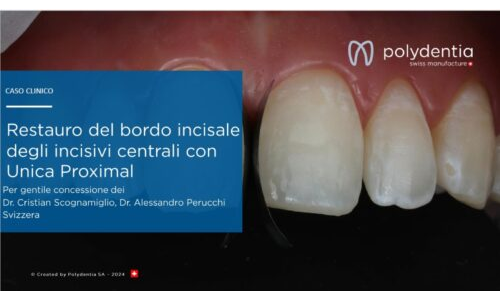 Dr Scognamiglio - Dr Perucchi - Restauro del bordo incisale degli incisivi centrali con Unica Proximal