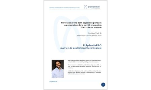 Dr. Giuseppe Chiodera –Protection de la dent adjacente – PolydentiaPRO matrice de protection interproximale