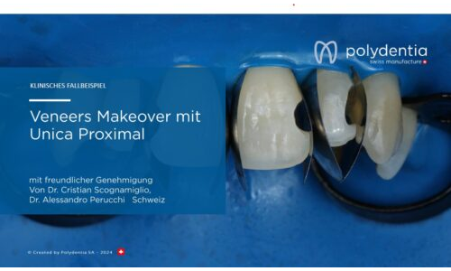 Dr Scognamiglio - Dr Perucchi - Veneers Makeover mit Unica Proximal Unica Proximal
