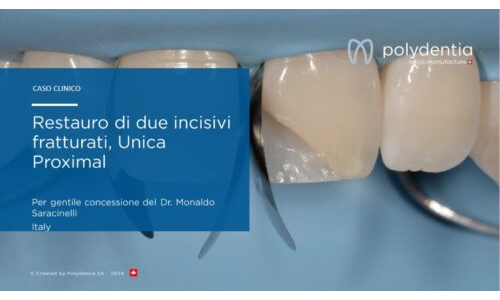 Dr Monaldo Saracinelli - Restauro di due incisivi fratturati  Unica Proximal