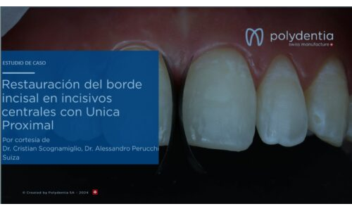 Dr Scognamiglio - Dr Perucchi - Restauración del borde incisal en incisivos centrales con Unica Proximal