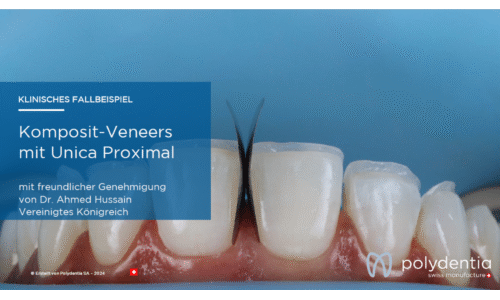 Dr Ahmed Hussain - Komposit-Veneers  mit Unica Proximal