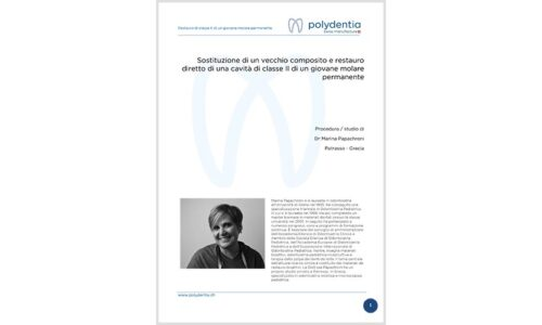 Dr. Marina Papachroni - Sostituzione di un vecchio composito e restauro diretto di una cavità di classe II di un giovane molare permanente - myRing Forte