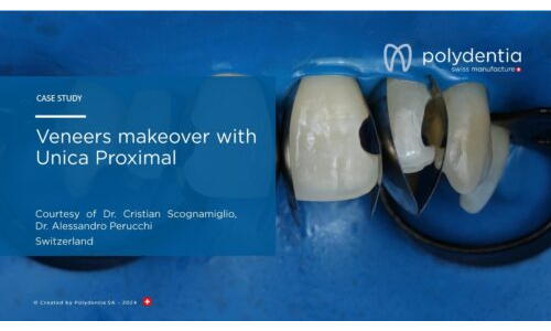 Dr Scognamiglio - Dr Perucchi - Veneers makeover with Unica Proximal
