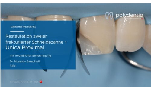 Dr Monaldo Saracinelli - Restauration zweier frakturierter Schneidezähne mit Unica proximal