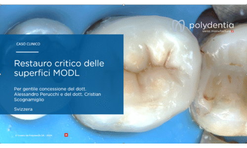 Dr Scognamiglio - Dr Perucchi - Restauro critico delle superfici MODL