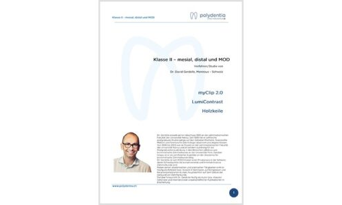 Dr. David Gerdolle – Klasse II mesial, distal und MOD – MyClip 2.0 + LumiContrast