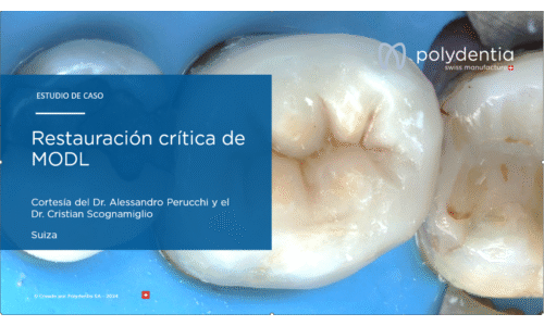 Dr Scognamiglio - Dr Perucchi - Restauración crítica de MODL