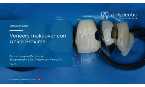 Dr Scognamiglio - Dr Perucchi - Veneers makeover con Unica Proximal