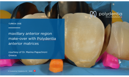 Dr. Marina Papachroni – maxillary anterior region make-over