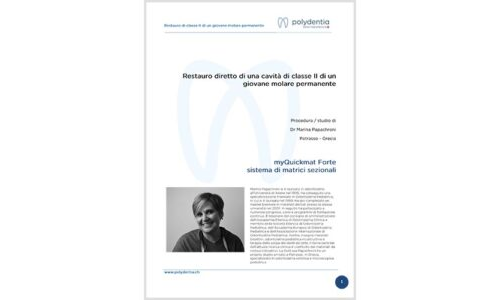 Dr. Marina Papachroni -Restauro diretto di una cavità di classe II di un giovane molare permanente – myQuickmat Forte