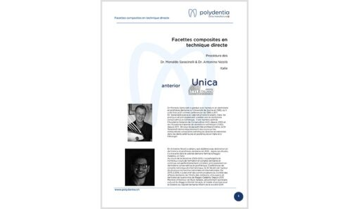 Dr. Saracinelli & Nicoló – Facettes composites en technique directe – Unica anterior