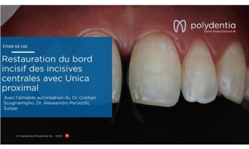 Dr Scognamiglio - Dr Perucchi - Restauration du bord incisif des incisives centrales avec Unica proximal