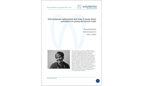 Dr. Marina Papachroni - Old composite replacement and Class II cavity direct restoration on young permanent molar - myRing Forte