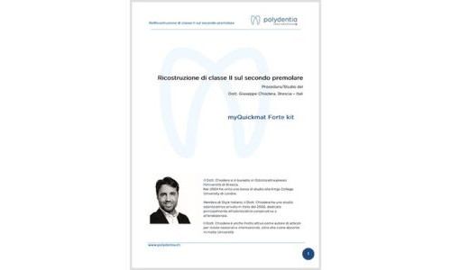 Dr. Giuseppe Chiodera – Ricostruzione di Classe II sul secondo premolare – myQuickmat Forte kit