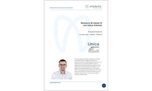 Dr. Dan Lazar – Restauro di classe IV con Unica anterior