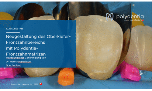 Dr. Marina Papachroni – Neugestaltung des Oberkiefer-Frontzahnbereichs  mit Polydentia-Frontzahnmatrizen